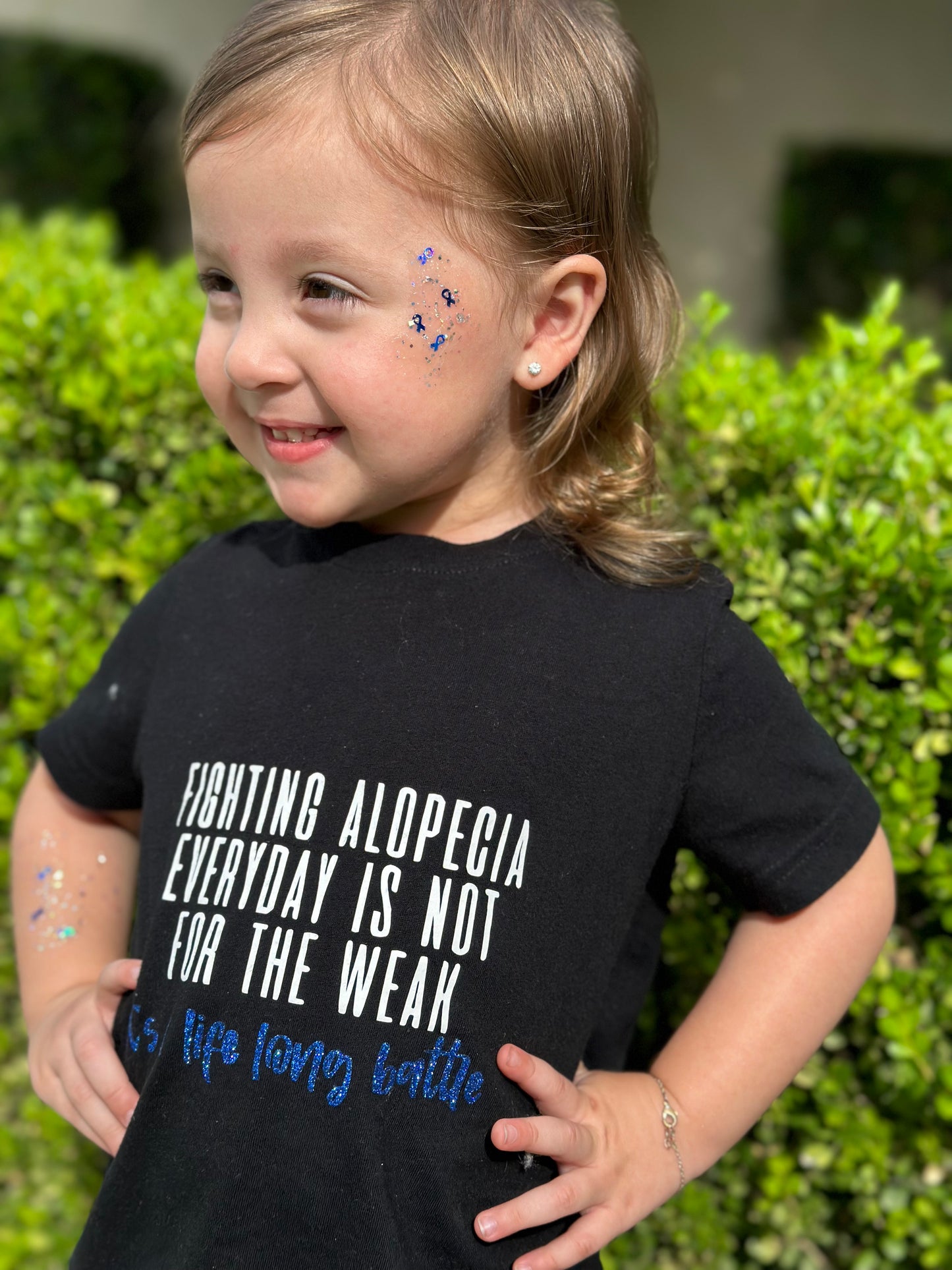 đź’™Alopecia Warriorđź’™